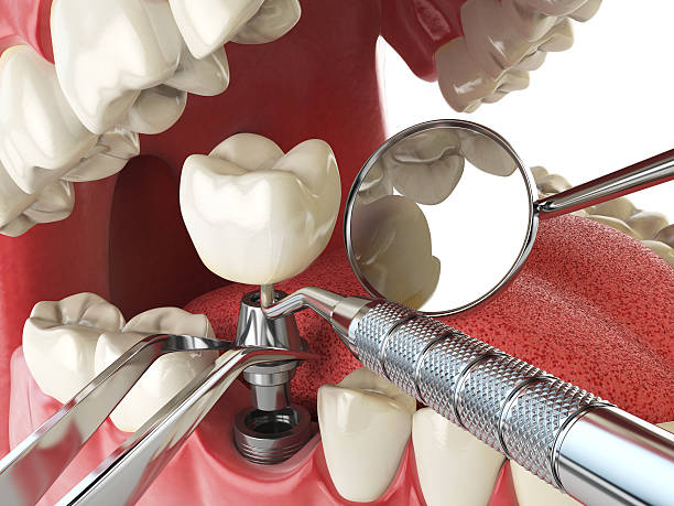 Best Emergency Orthodontic Repairs in Novato, CA